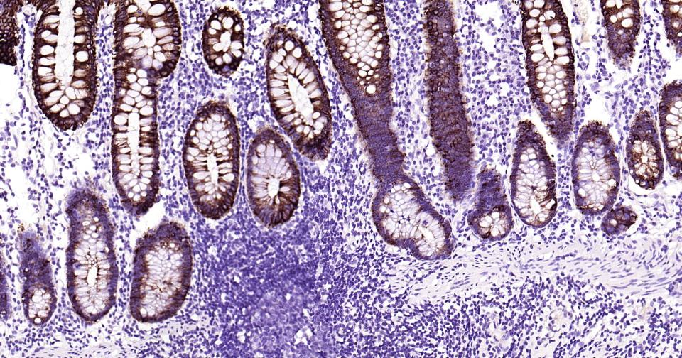 细胞角蛋白19重组兔单抗-bsm-52059R