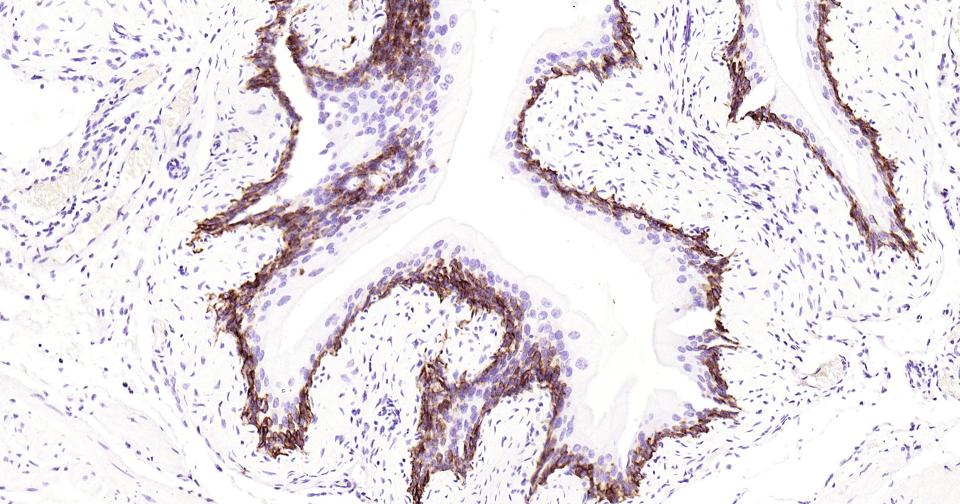 细胞角蛋白5重组兔单抗-bsm-52063R