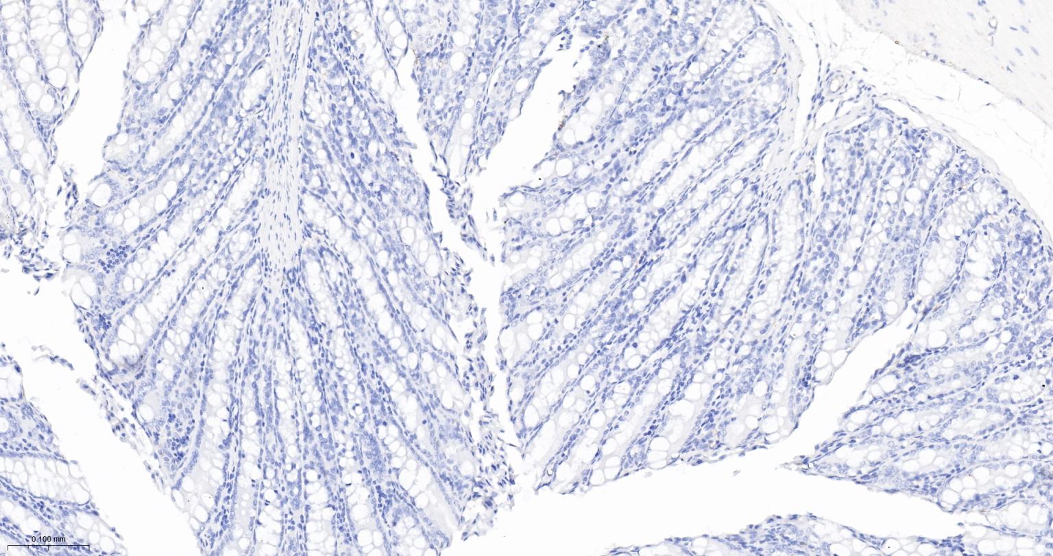 细胞角蛋白5重组兔单抗-bsm-52063R