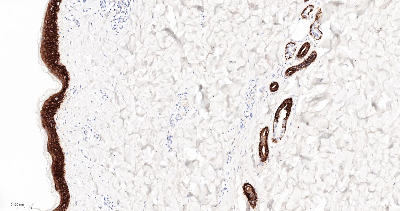 细胞角蛋白5重组兔单抗-bsm-52063R