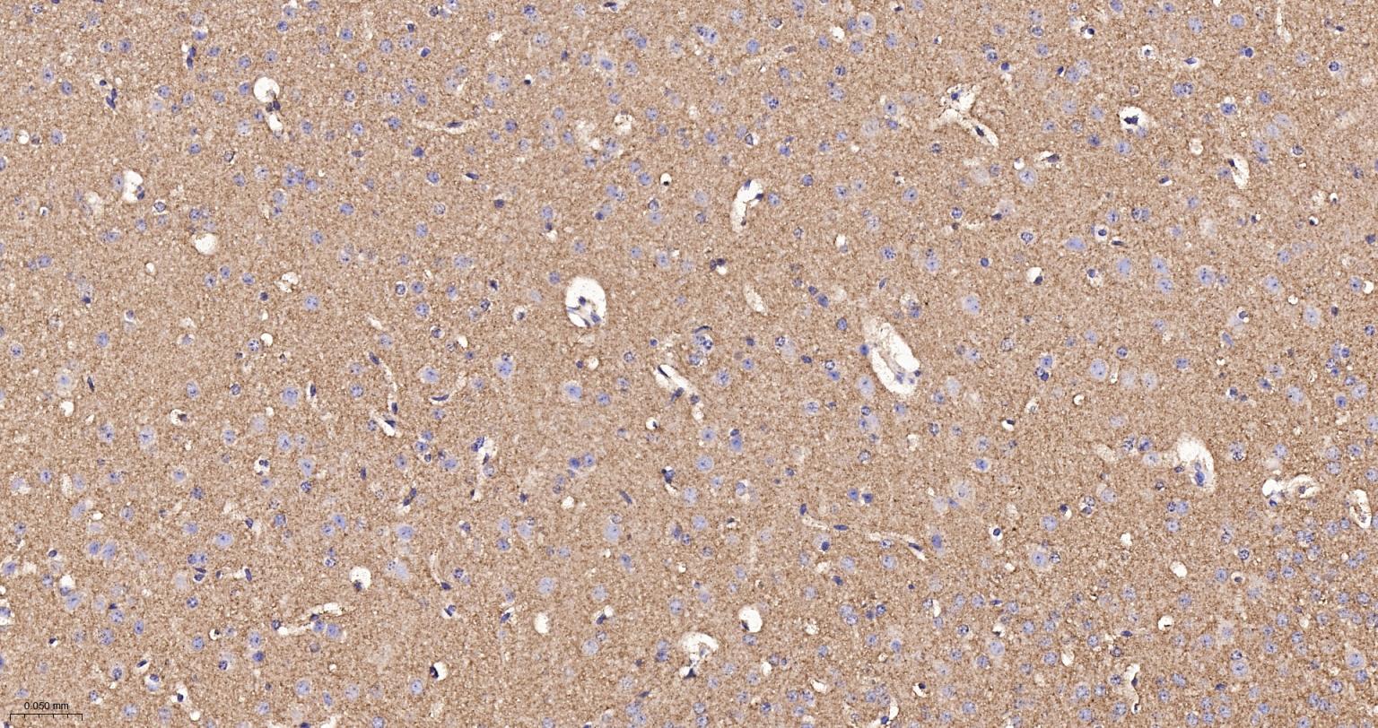 己糖激酶1重组兔单抗-bsm-61212R