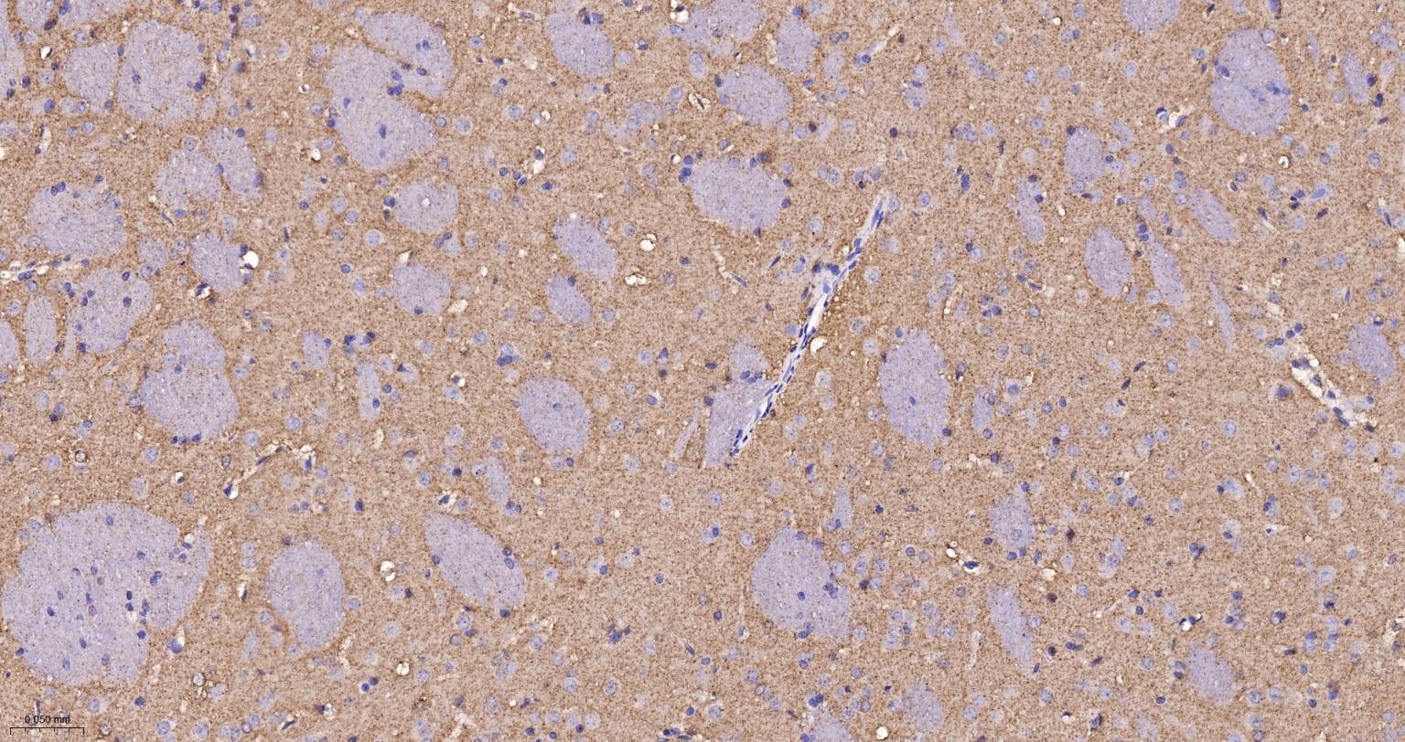 己糖激酶1重组兔单抗-bsm-61212R