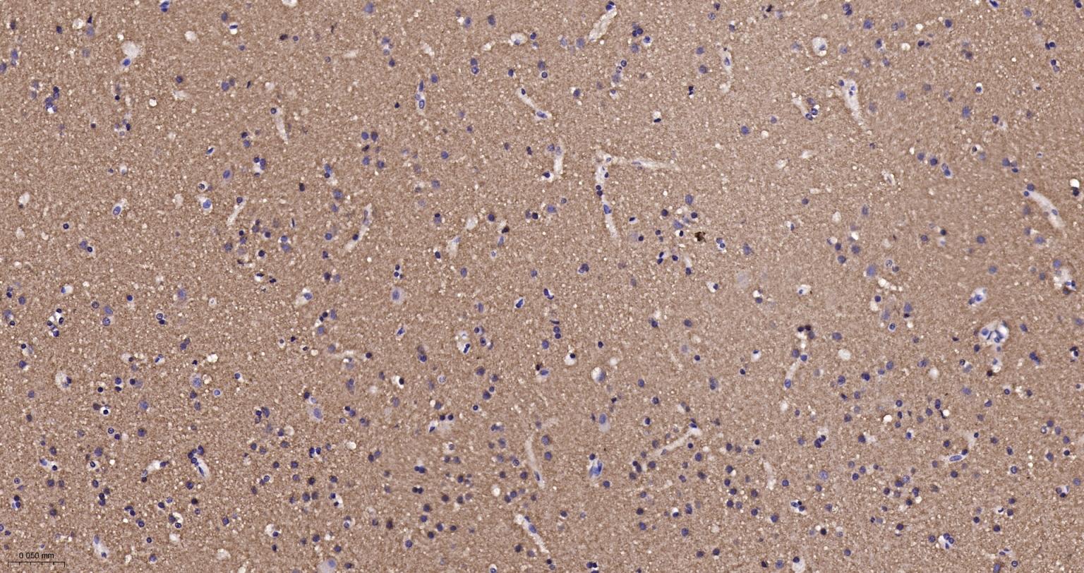 己糖激酶1重组兔单抗-bsm-61212R