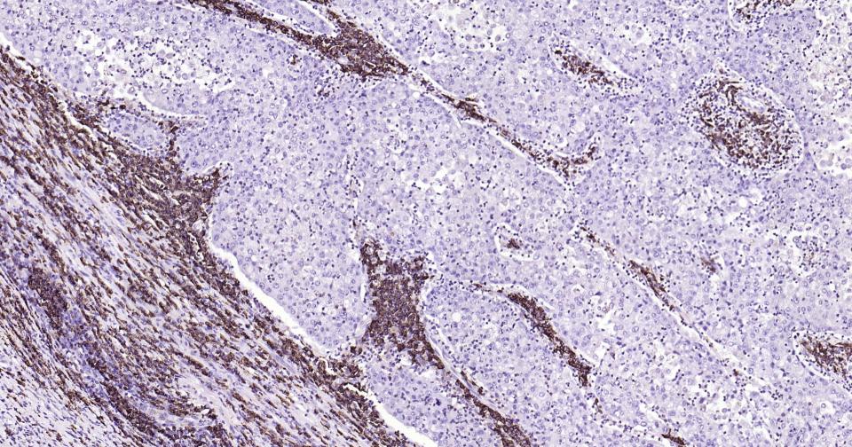 CD38重组兔单抗-bsm-52623R