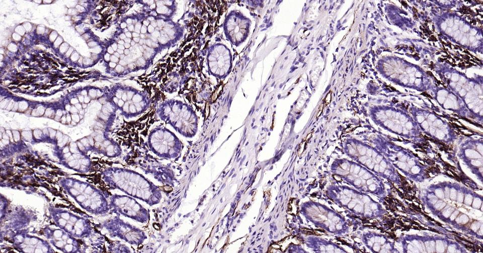 CD38重组兔单抗-bsm-52623R
