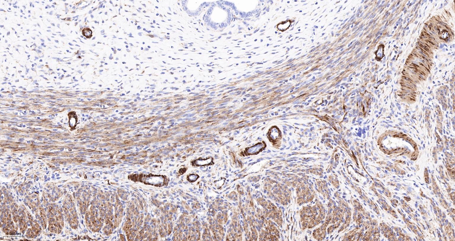 结蛋白重组兔单抗-bsm-60266R
