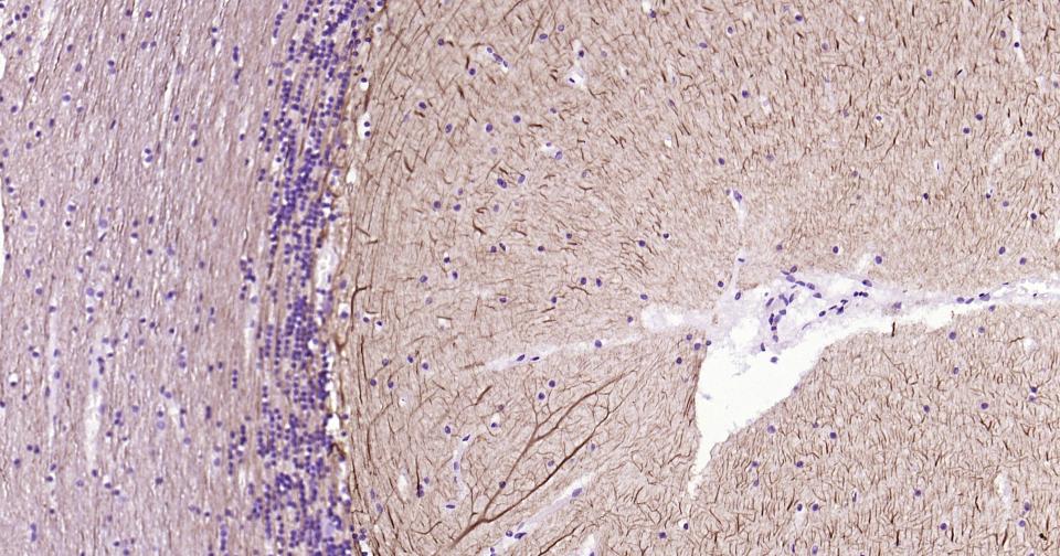 α-中连蛋白重组兔单抗-bsm-54173R
