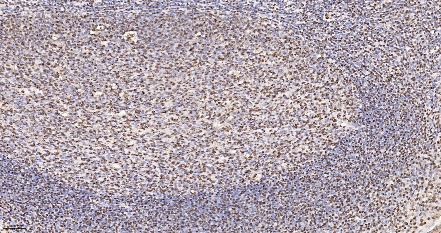 扑克蒙蛋白重组兔单抗-bsm-62165R