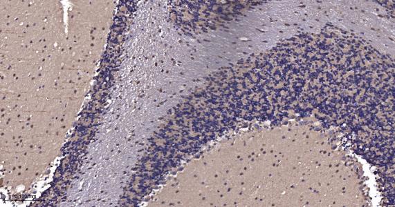 周期素依赖性激酶5重组兔单抗-bsm-52029R