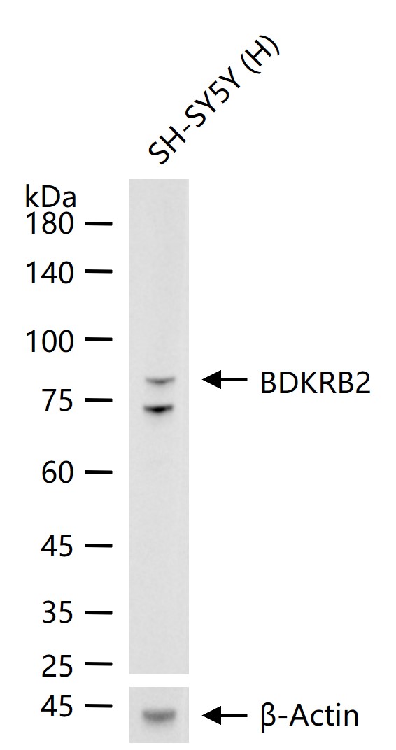 缓激肽B2受体重组兔单抗-bsm-61836R