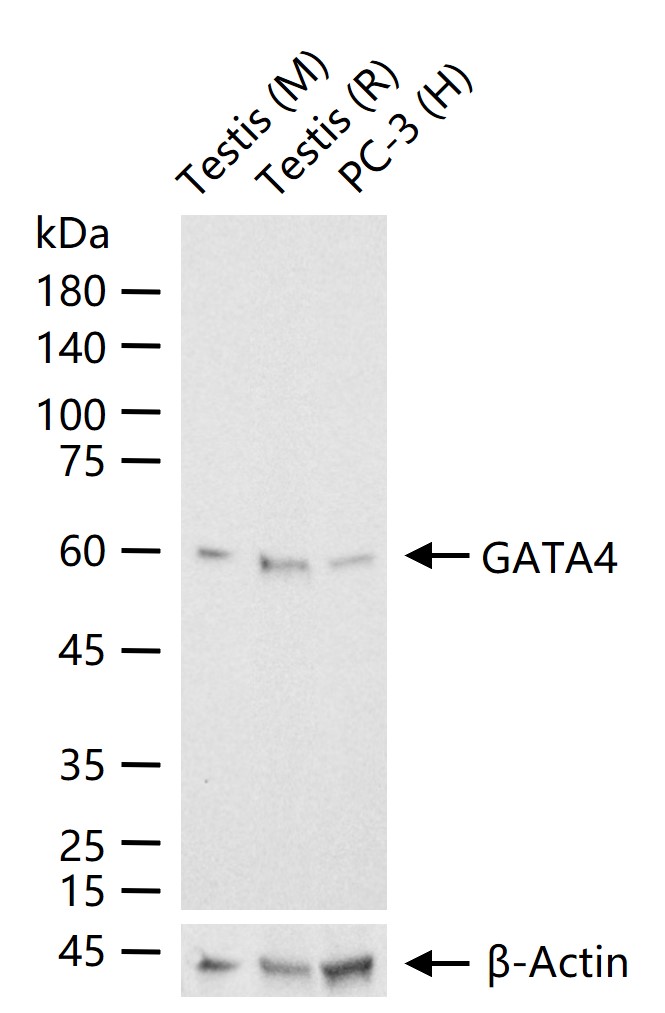 GATA结合蛋白4重组兔单抗-bsm-61462R