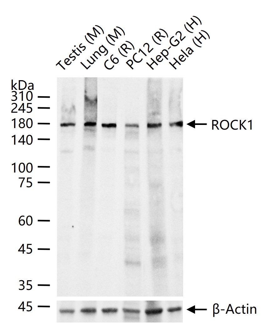 Rho相关蛋白激酶1重组兔单抗-bsm-62969R