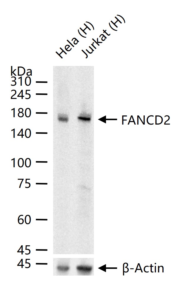 FANCD2重组兔单抗-bsm-61302R
