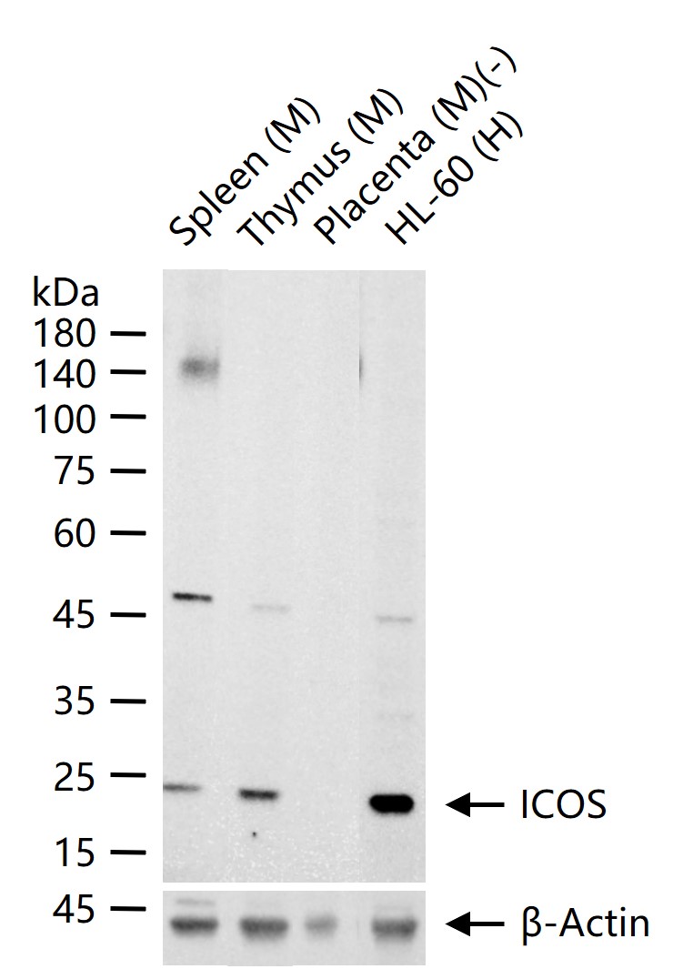 诱导协同刺激分子CD278重组兔单抗-bsm-60227R