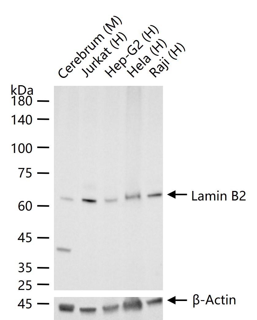 核纤层蛋白B2重组兔单抗-bsm-61648R