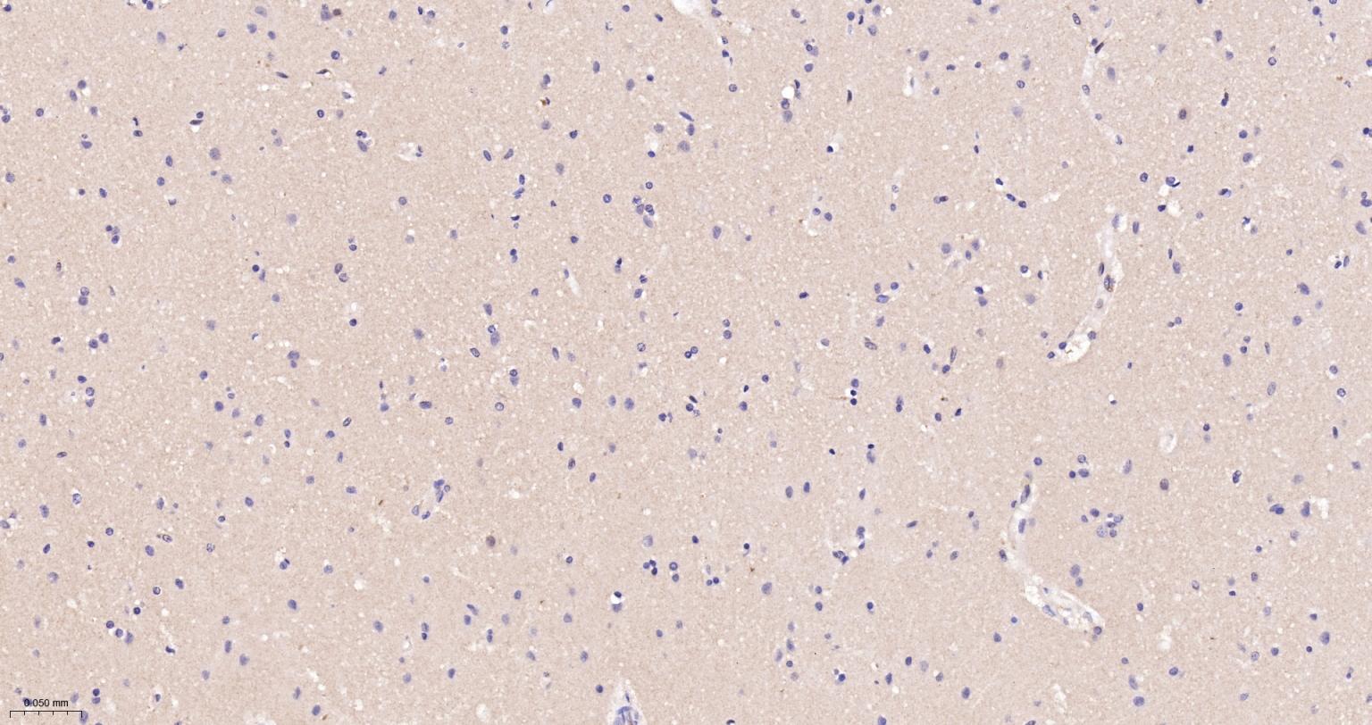 神经性舞蹈病蛋白重组兔单抗-bsm-54305R