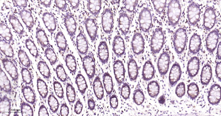 40S核糖体蛋白S20重组兔单抗-bsm-60503R