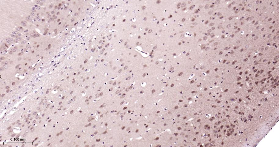 蛋白酶体PSMα2重组兔单抗-bsm-62091R