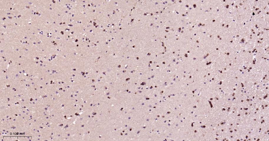 热休克蛋白-70重组兔单抗-bsm-52241R