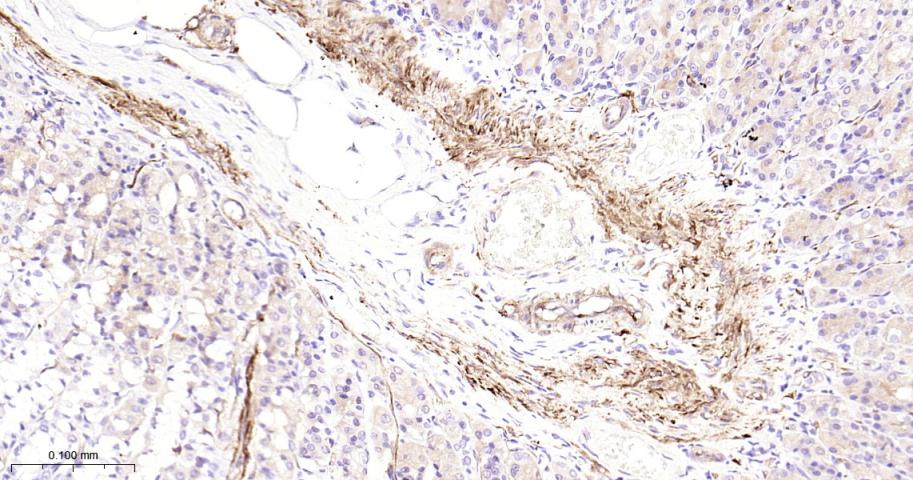 热休克蛋白27重组兔单抗-bsm-52757R