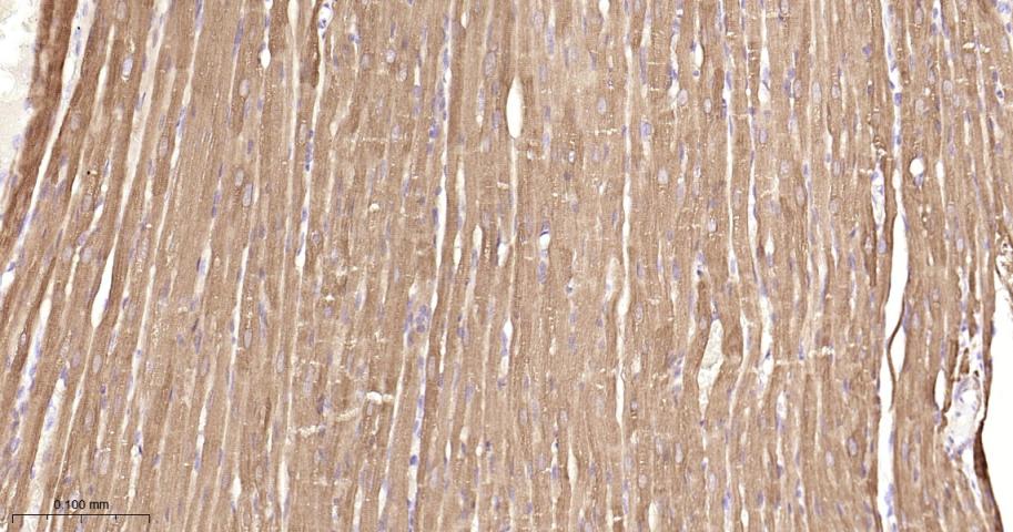 热休克蛋白27重组兔单抗-bsm-52757R