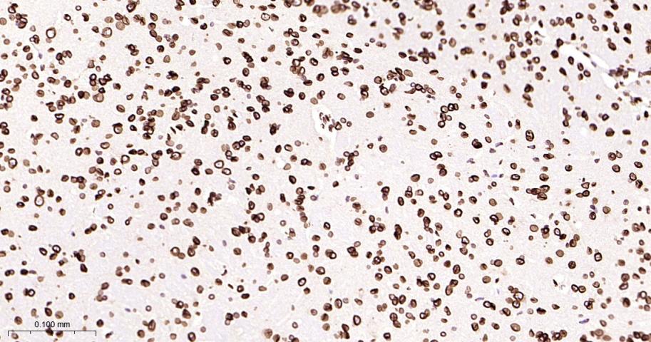 核纤层蛋白B2重组兔单抗-bsm-61648R