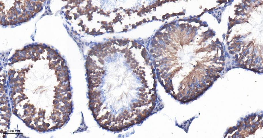 IFT88重组兔单抗-bsm-62706R
