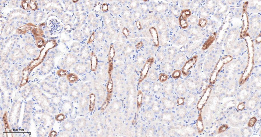 IFT88重组兔单抗-bsm-62706R
