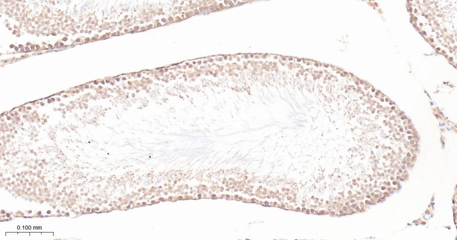 泛素激活酶E1重组兔单抗-bsm-63004R
