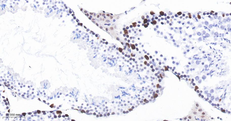 组蛋白去乙酰化酶2重组兔单抗-bsm-52082R