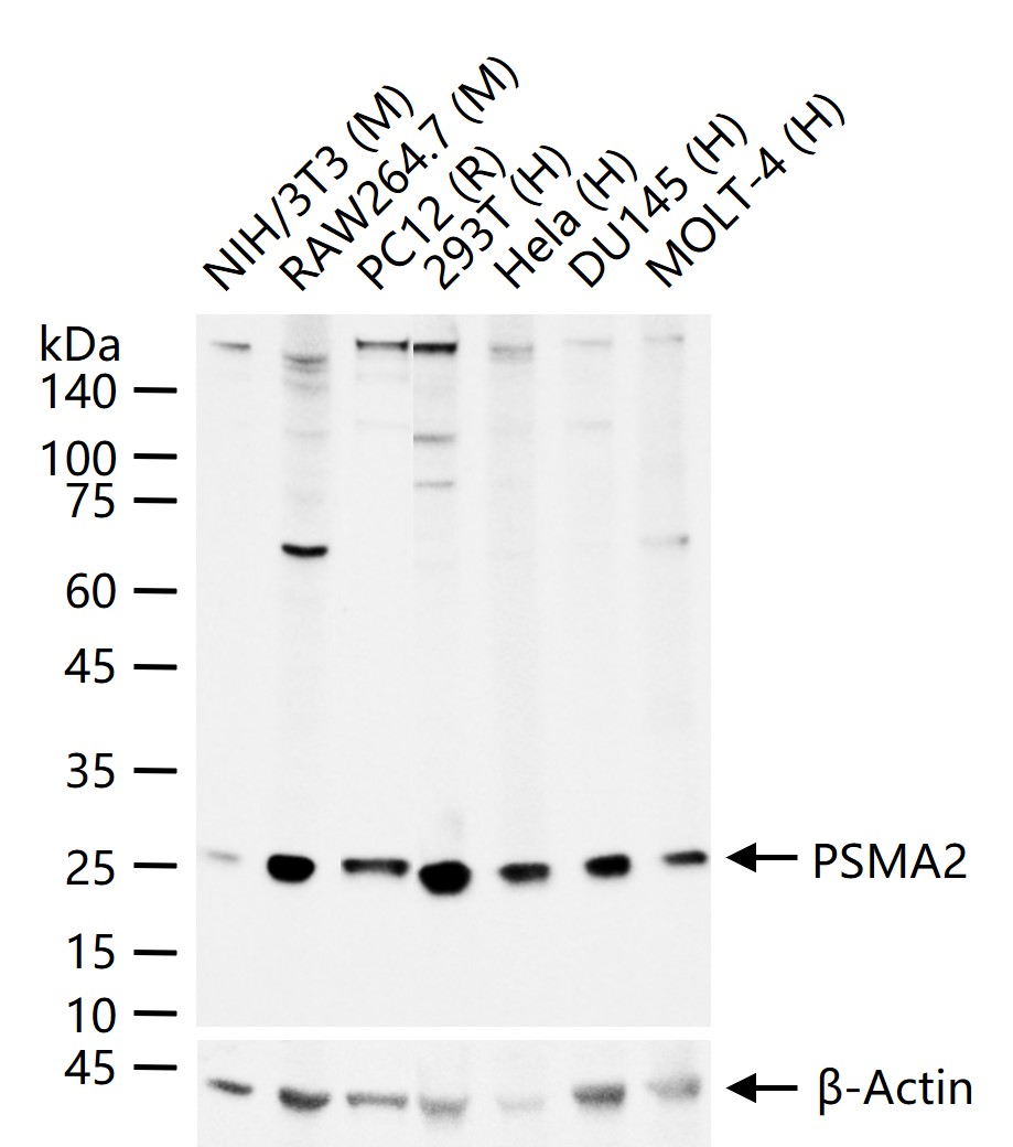 蛋白酶体PSMα2重组兔单抗-bsm-62091R