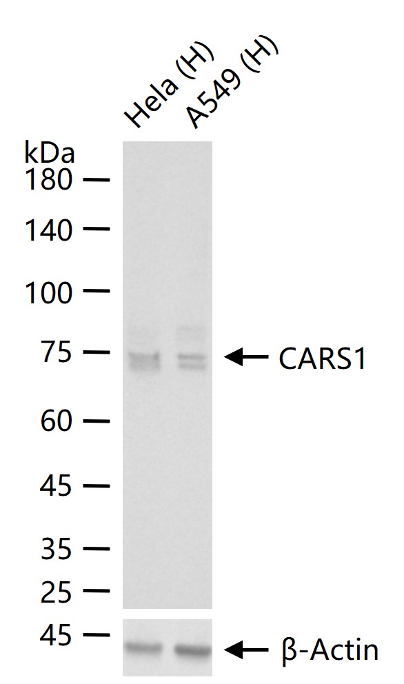 CARS1重组兔单抗-bsm-62444R
