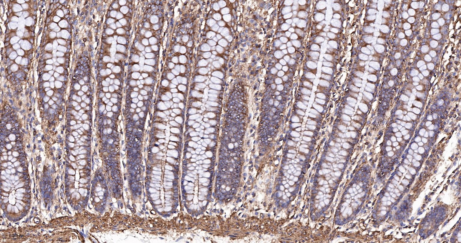 α-SMA重组兔单抗-bsm-52396R