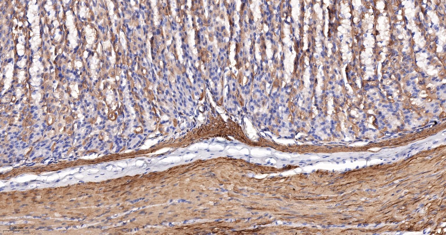 α-SMA重组兔单抗-bsm-52396R