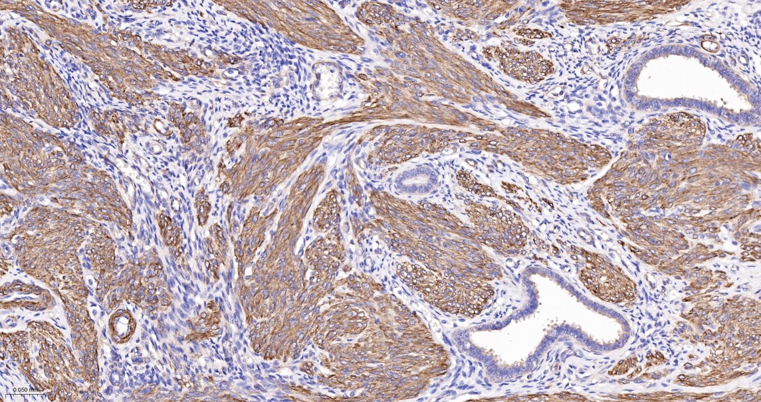 α-SMA重组兔单抗-bsm-52396R