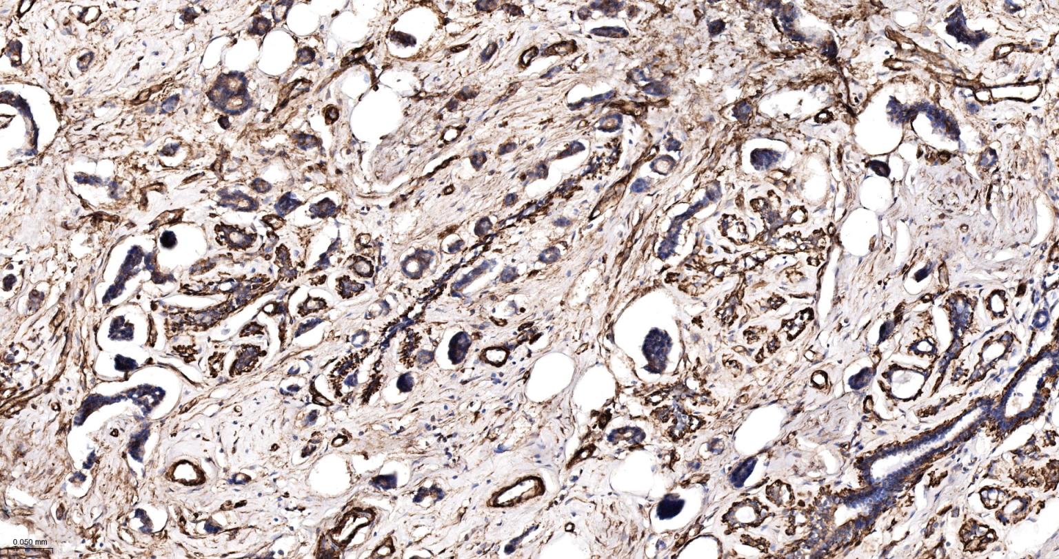 α-SMA重组兔单抗-bsm-52396R