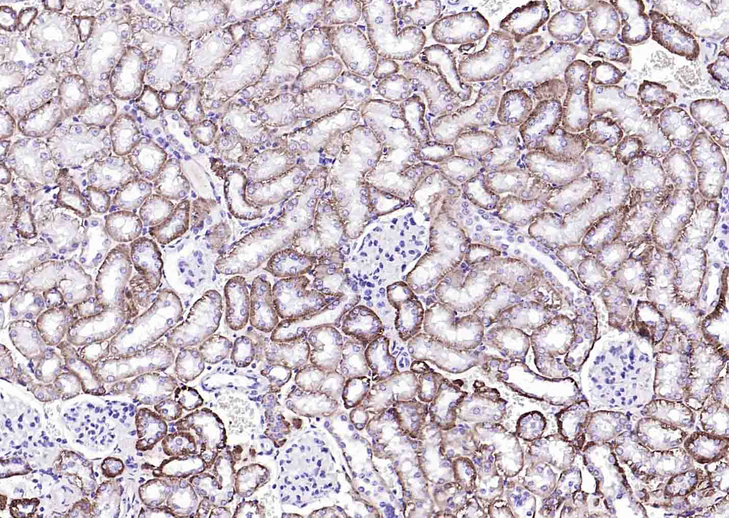 Na+/K+-ATPase α1 钠钾ATP酶α1抗体-bs-9570R