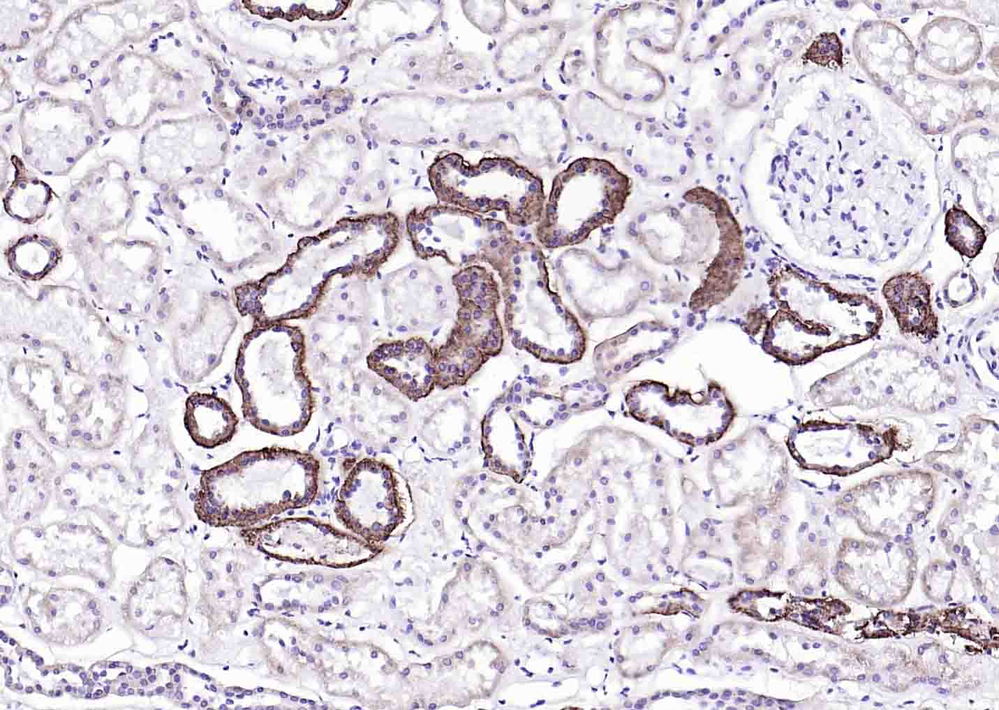 Na+/K+-ATPase α1 钠钾ATP酶α1抗体-bs-9570R