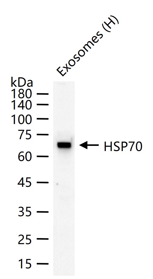 热休克蛋白-70重组兔单抗-bsm-52241R