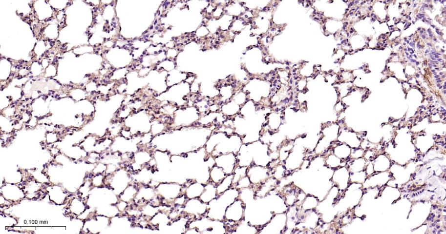 黑色素瘤细胞粘附分子CD146重组兔单抗-bsm-61136R