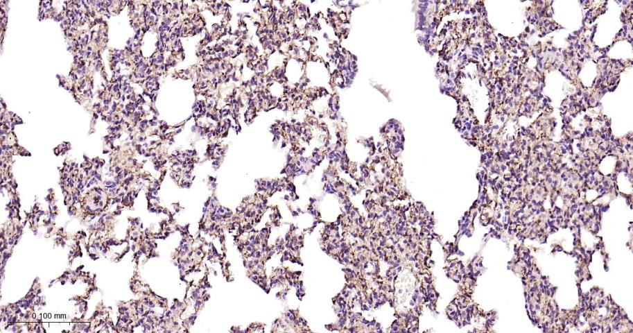 黑色素瘤细胞粘附分子CD146重组兔单抗-bsm-61136R
