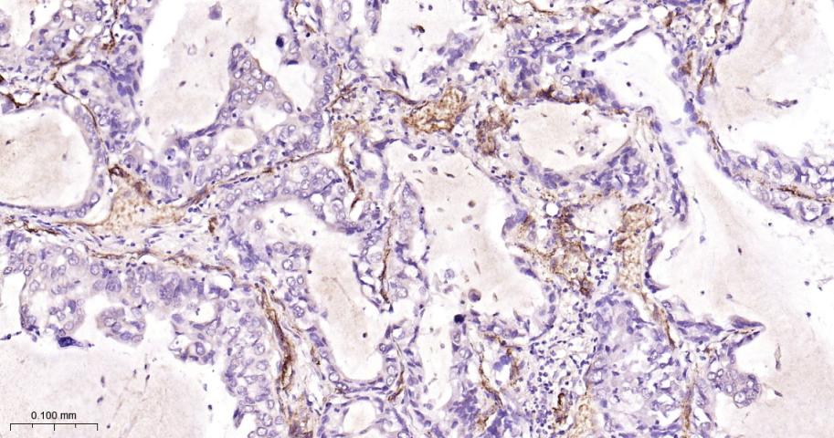 黑色素瘤细胞粘附分子CD146重组兔单抗-bsm-61136R