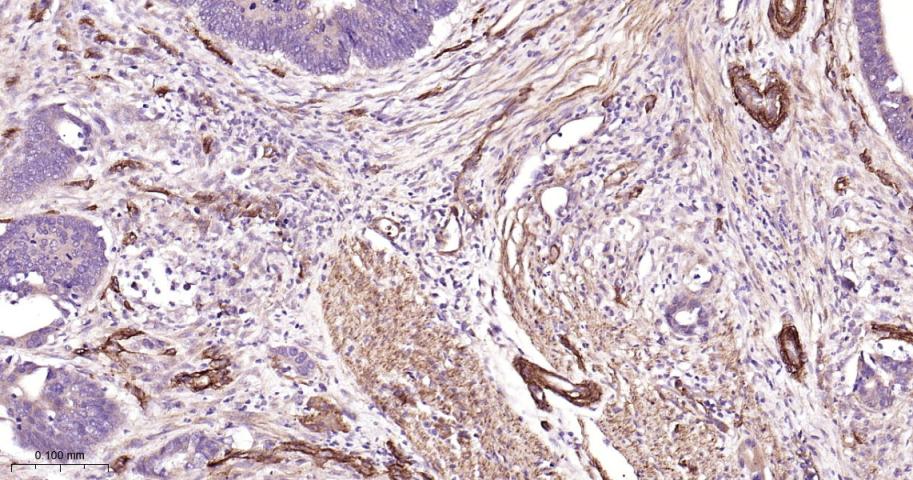 黑色素瘤细胞粘附分子CD146重组兔单抗-bsm-61136R