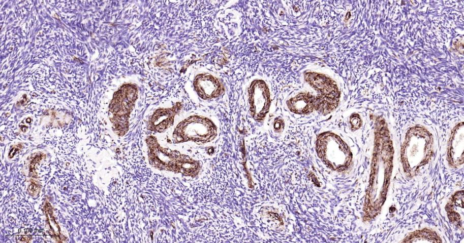 黑色素瘤细胞粘附分子CD146重组兔单抗-bsm-61136R