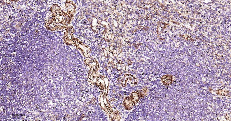黑色素瘤细胞粘附分子CD146重组兔单抗-bsm-61136R