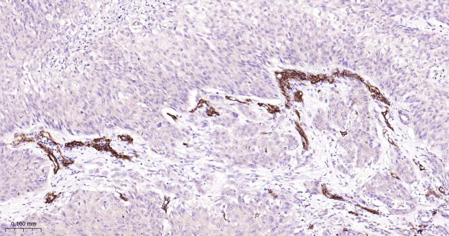 黑色素瘤细胞粘附分子CD146重组兔单抗-bsm-61136R