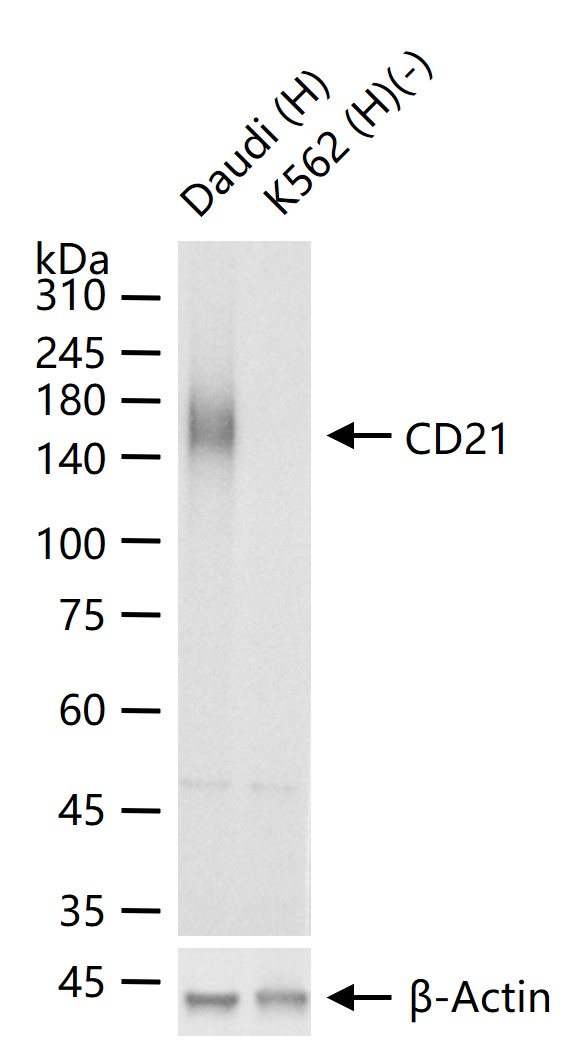 CR2重组兔单抗-bsm-60246R