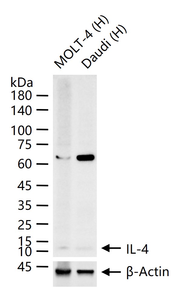 白介素4重组兔单抗-bsm-54002R