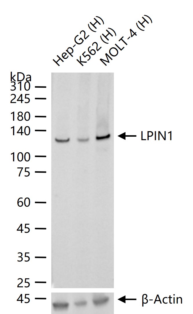 磷脂酸磷酸酯酶LPIN1重组兔单抗-bsm-61915R