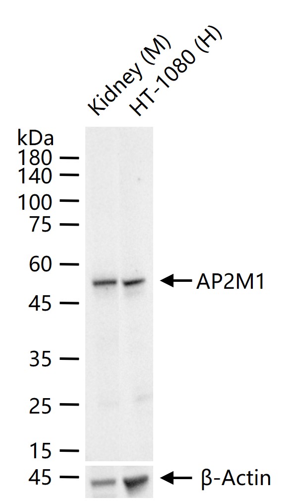 接头相关蛋白复合体AP-2μ链1重组兔单抗-bsm-61305R